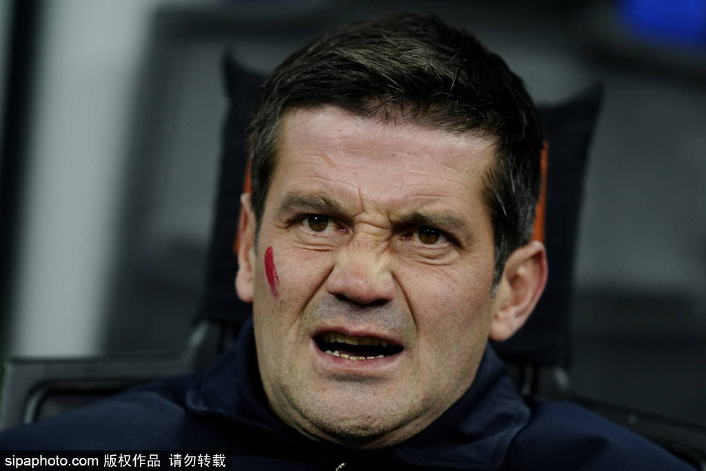 มิลานดาร์บี้สุดเดือด! เหตุการณ์ 'ดึงผม' ของอาเซอร์บี้และเลเอาจุดระเบิดทั้งสนาม_การแข่งขัน_ปะทะ_อินเตอร์